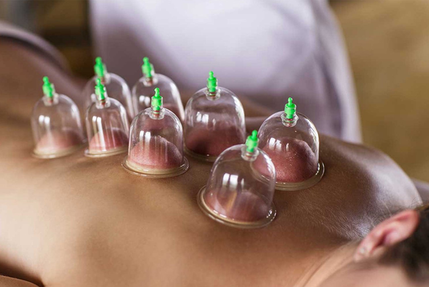 Cupping Service